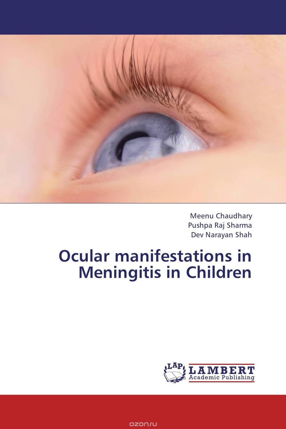Скачать книгу "Ocular manifestations in Meningitis in Children"