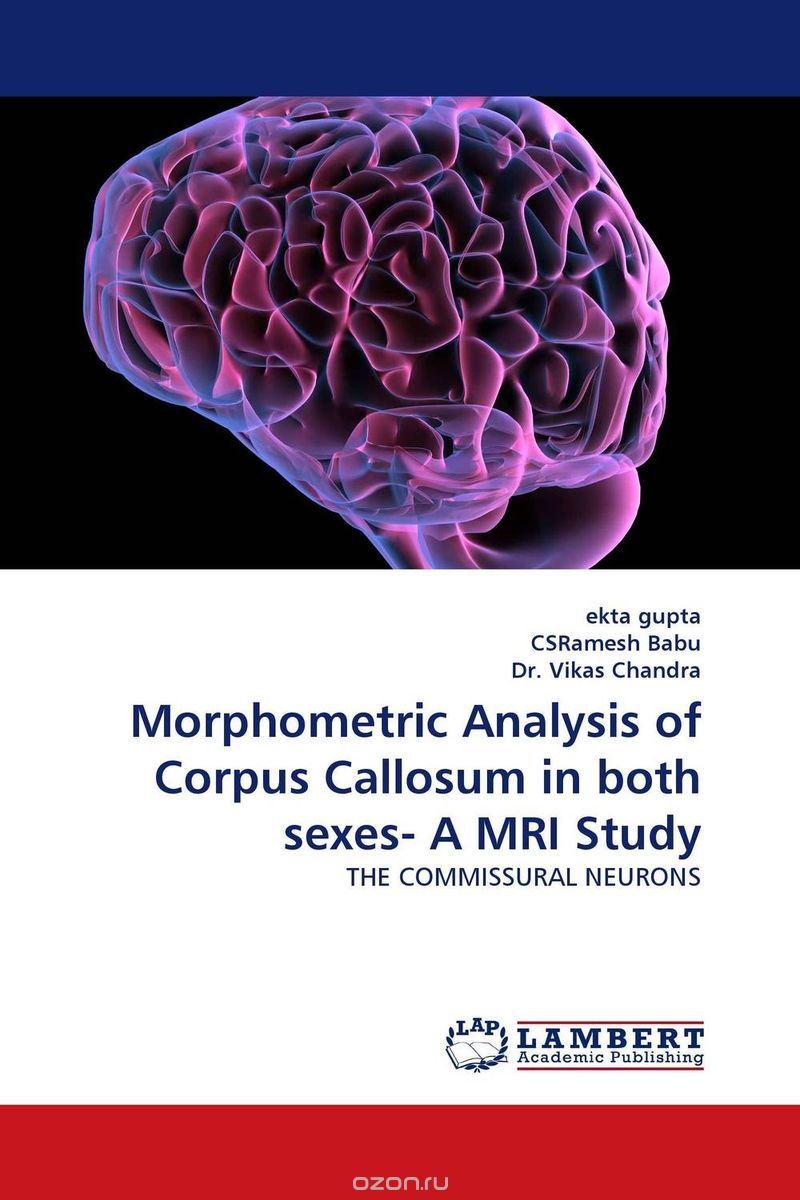 Скачать книгу "Morphometric Analysis of Corpus Callosum in both sexes- A MRI Study"