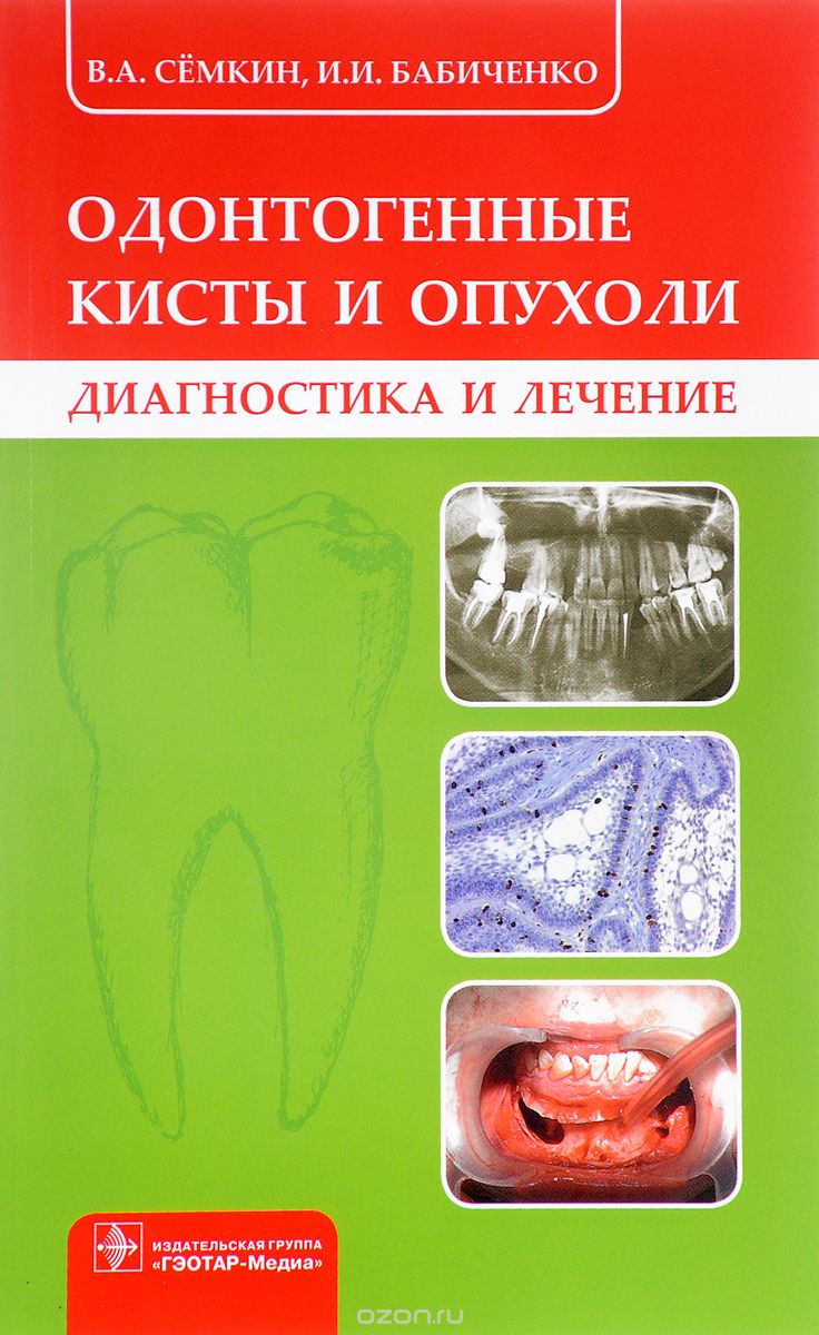 Скачать книгу "Одонтогенные кисты и опухоли, В. А. Сёмкин, И. И. Бабиченко"