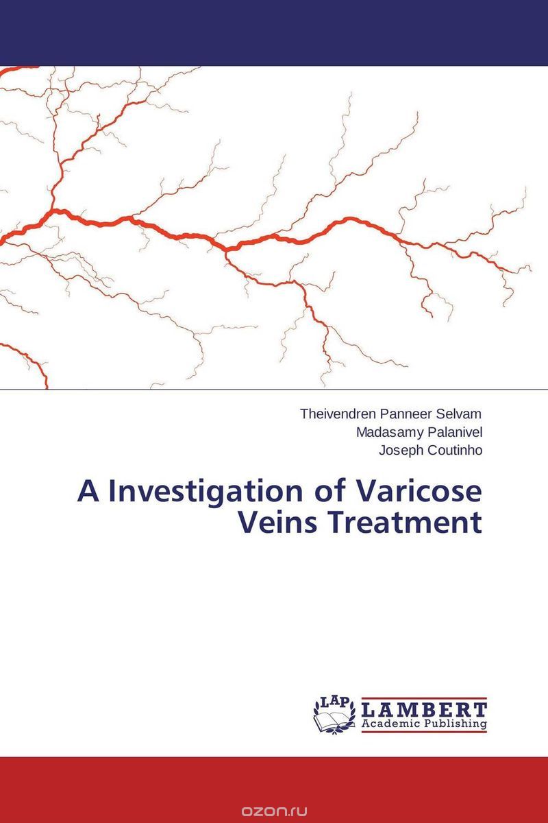 Скачать книгу "A Investigation of Varicose Veins Treatment"