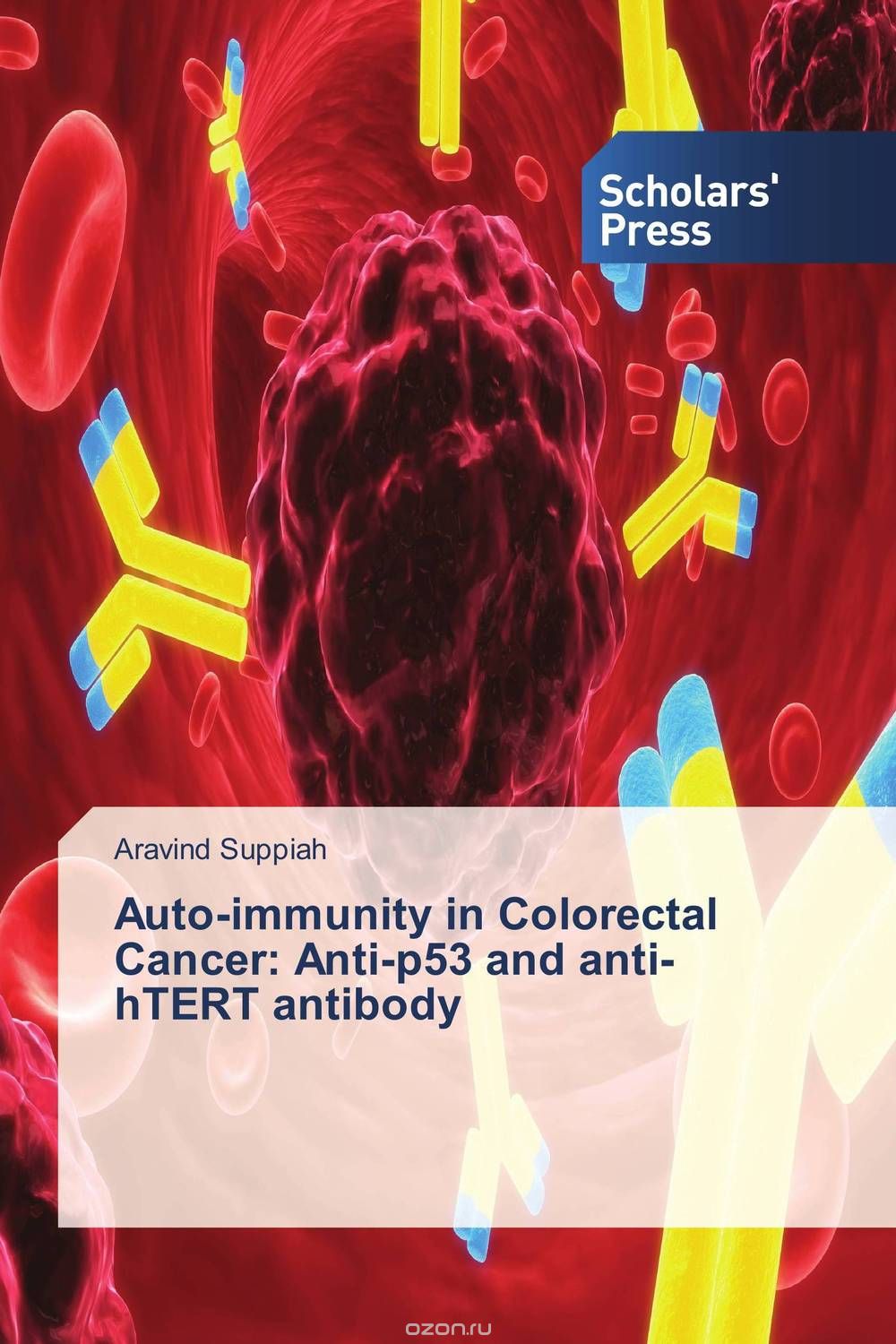 Скачать книгу "Auto-immunity in Colorectal Cancer: Anti-p53 and anti-hTERT antibody"