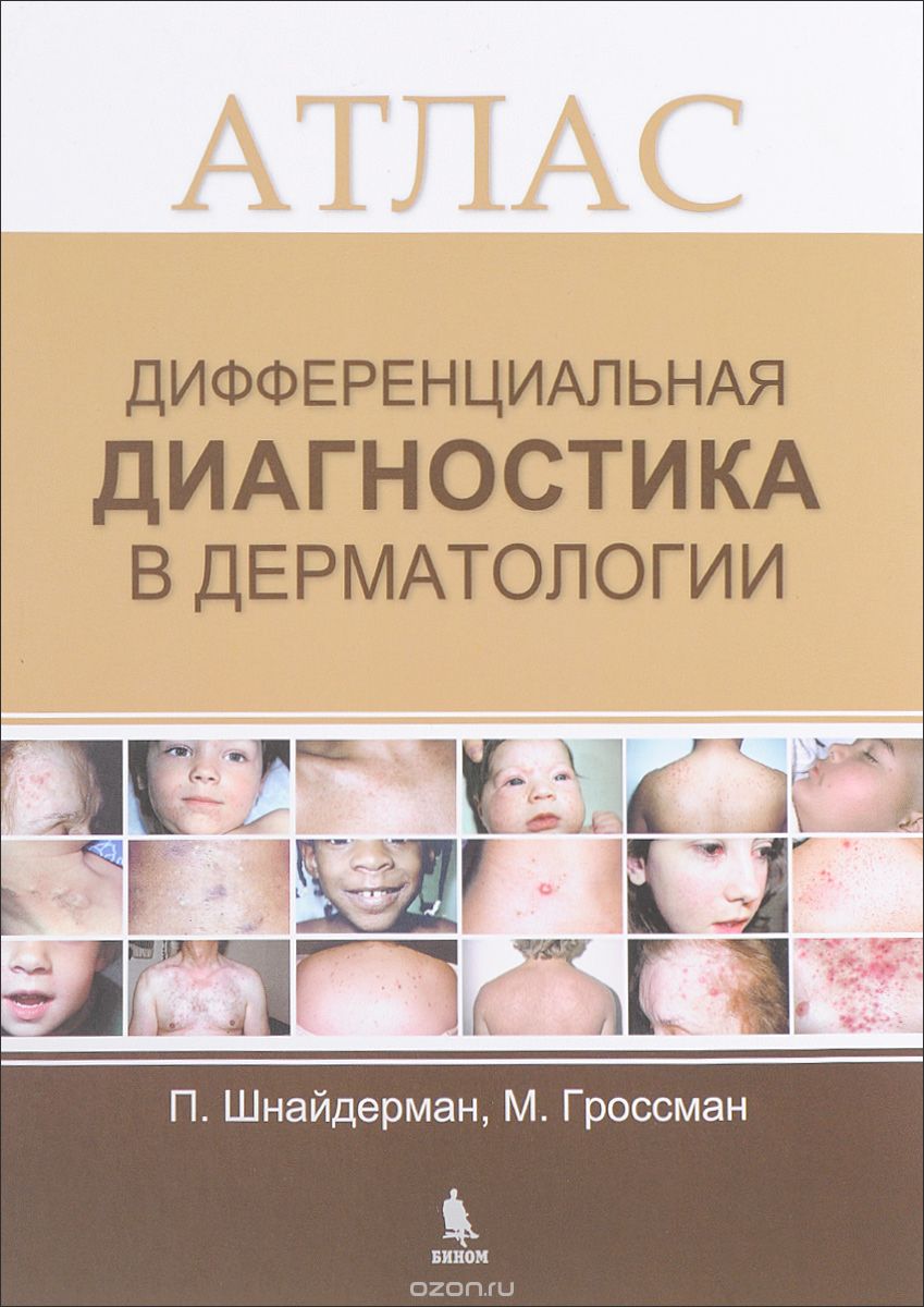Дифференциальная диагностика в дерматологии. Атлас, П. Шнайдерман, М. Гроссман