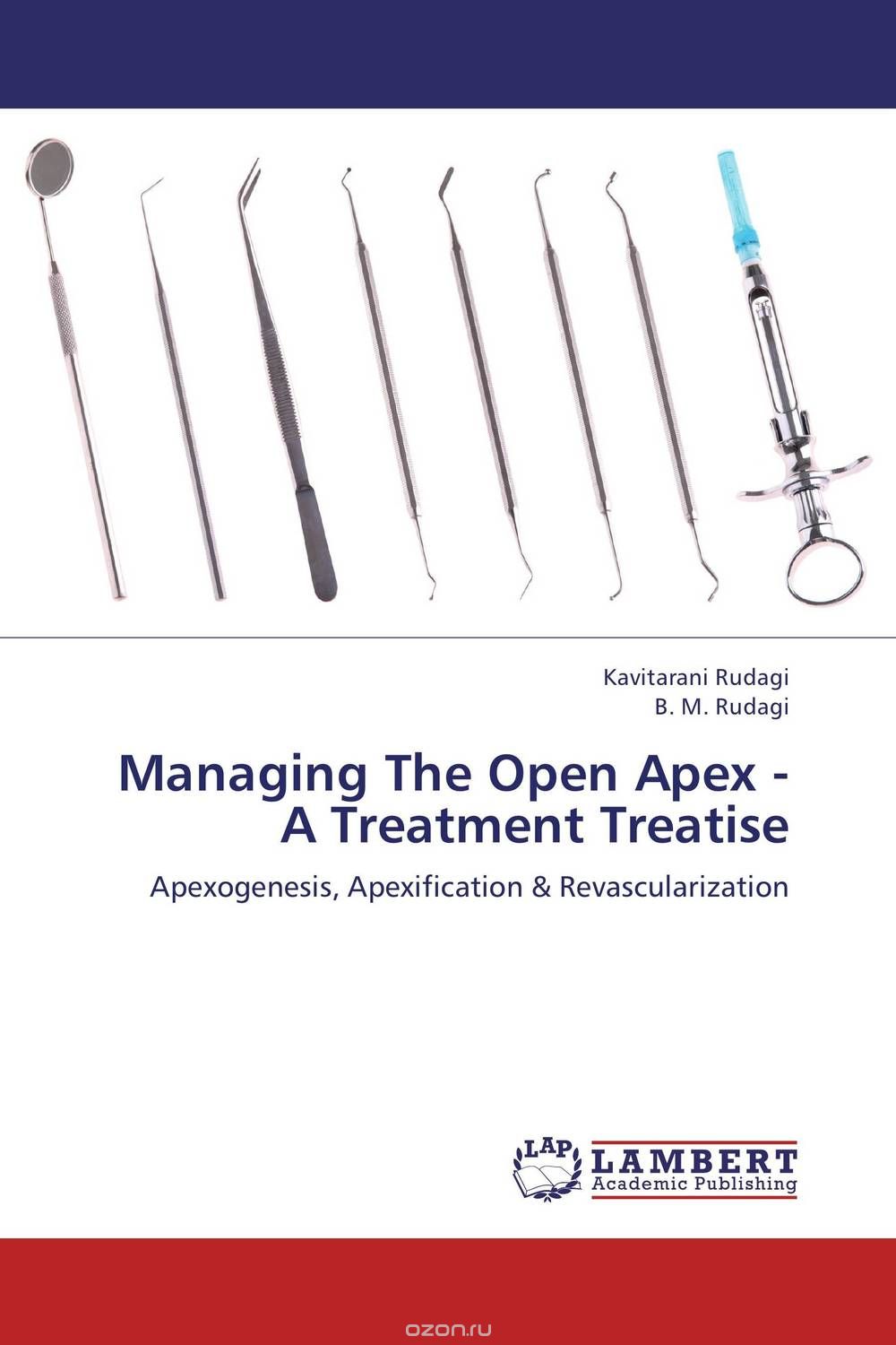 Managing The Open Apex - A Treatment Treatise