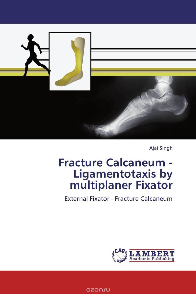 Скачать книгу "Fracture Calcaneum - Ligamentotaxis by multiplaner Fixator"
