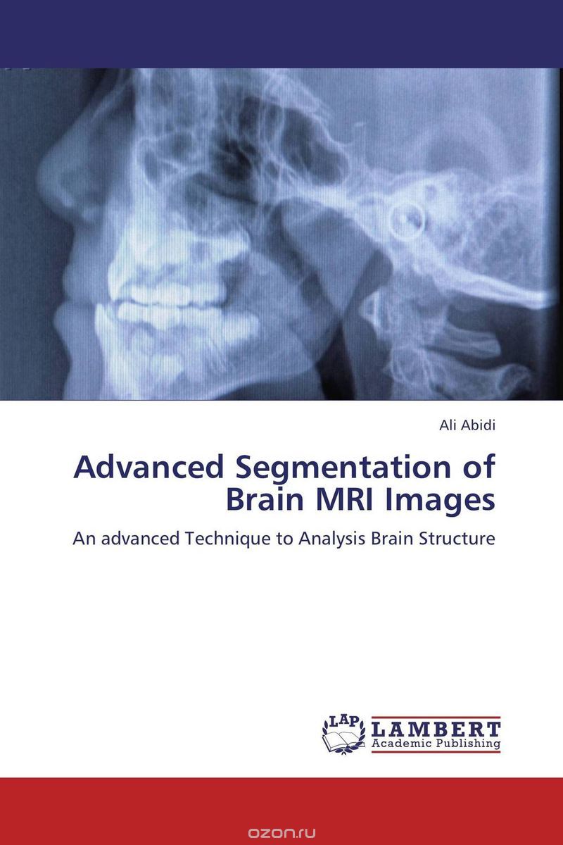 Скачать книгу "Advanced Segmentation of Brain MRI Images"
